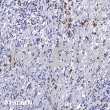 PROGEN-纯化抗钙卫蛋白S100A8/A9复合物小鼠单克隆抗体促销中