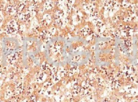 PROGEN-纯化抗甲胎蛋白（AFP）小鼠单克隆抗体C3促销