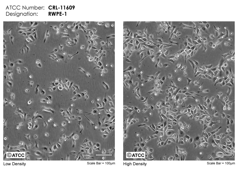 RWPE-1细胞图片
