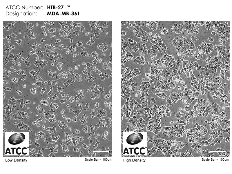 MDA-MB-361细胞图片