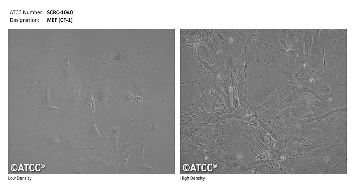 MEF (CF-1)细胞图片