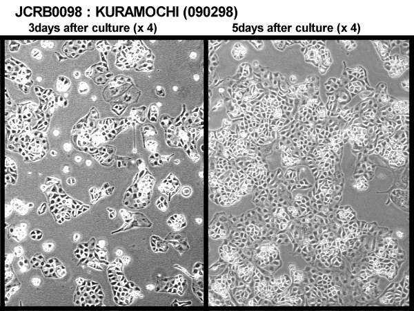 ATCC CCL-228 Kuramochi细胞图片