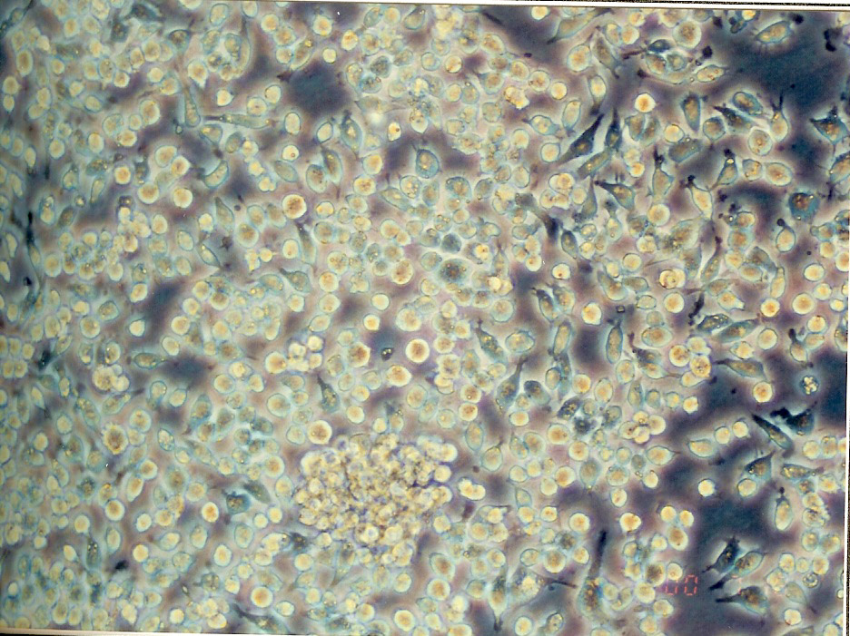 P388D1 (IL-1)细胞图片