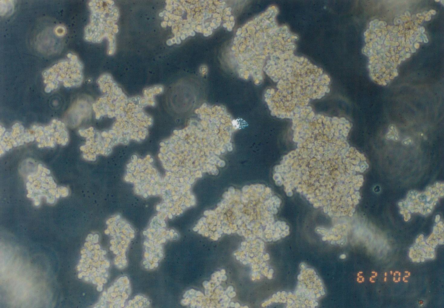 Y79细胞图片