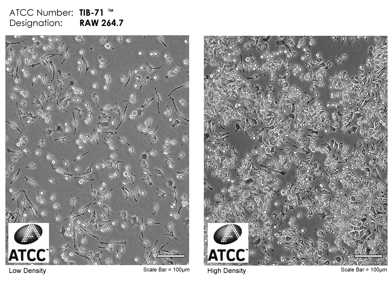 小鼠单核巨噬细胞白血病细胞RAW264.7(种属鉴定)