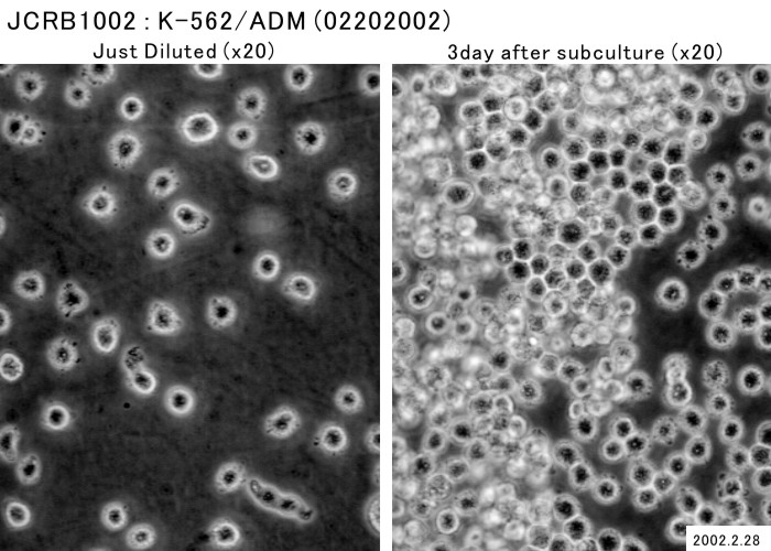 K562/ADR细胞,K562ADR细胞, 人慢性髓系白血病