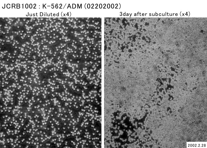 K562/ADR细胞,K562ADR细胞, 人慢性髓系白血病