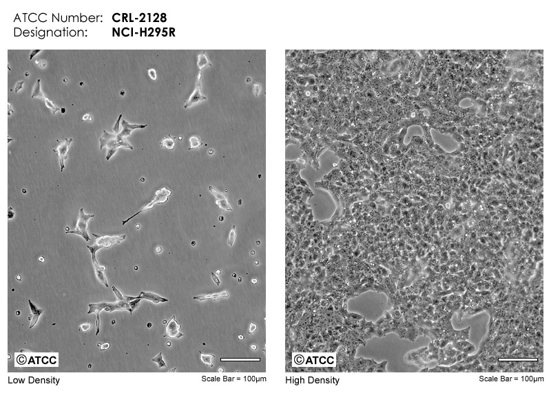 NCI-H295R细胞图片