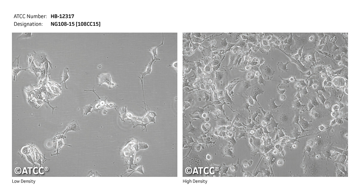 NG108-15细胞图片