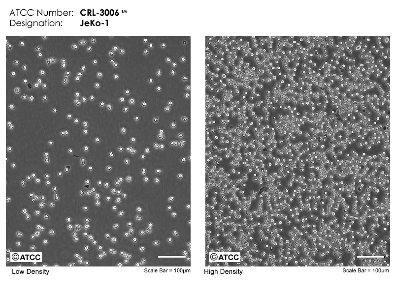 JeKo-1细胞图片