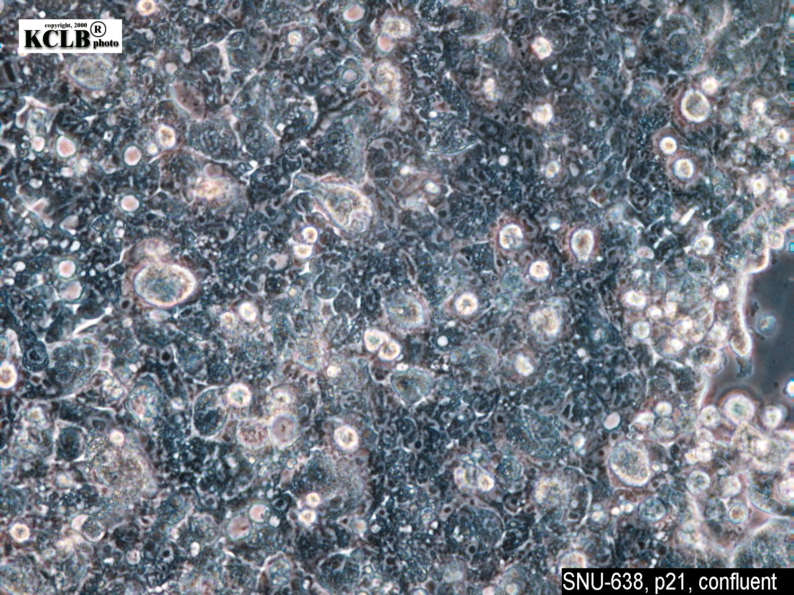SNU-638细胞图片