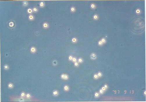 COLO 205细胞图片