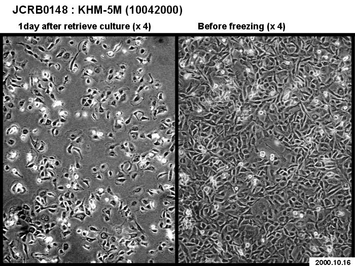 KHM-5M细胞图片