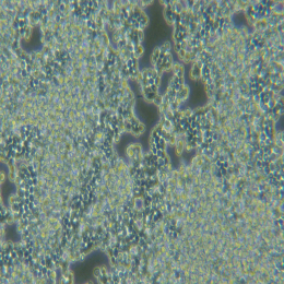 兔胰腺星状细胞