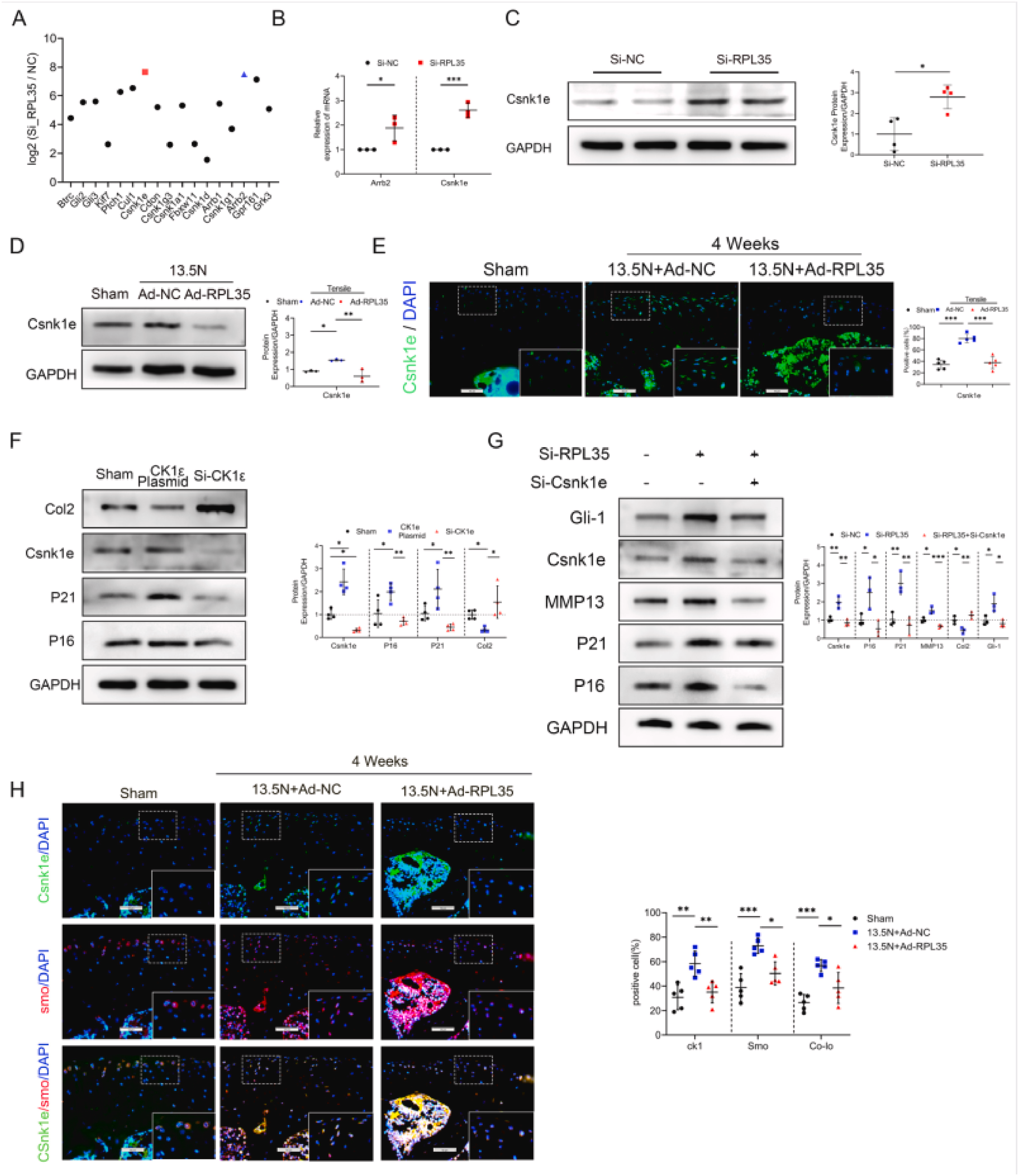 机械超负荷下调核糖体蛋白L35 通过 Hedgehog-Gli1 信号促进软骨细胞衰老和骨关节炎进展