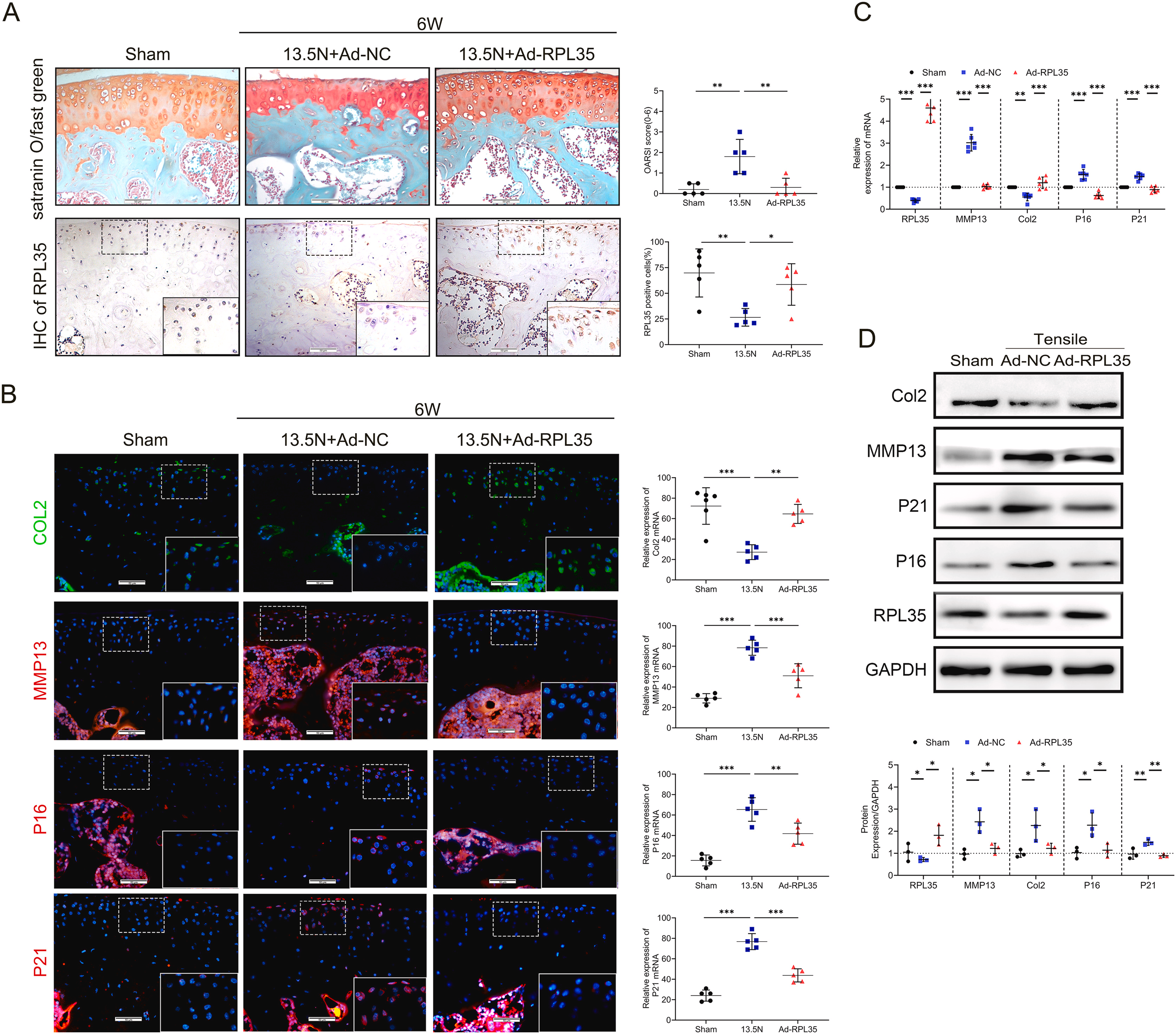 机械超负荷下调核糖体蛋白L35 通过 Hedgehog-Gli1 信号促进软骨细胞衰老和骨关节炎进展