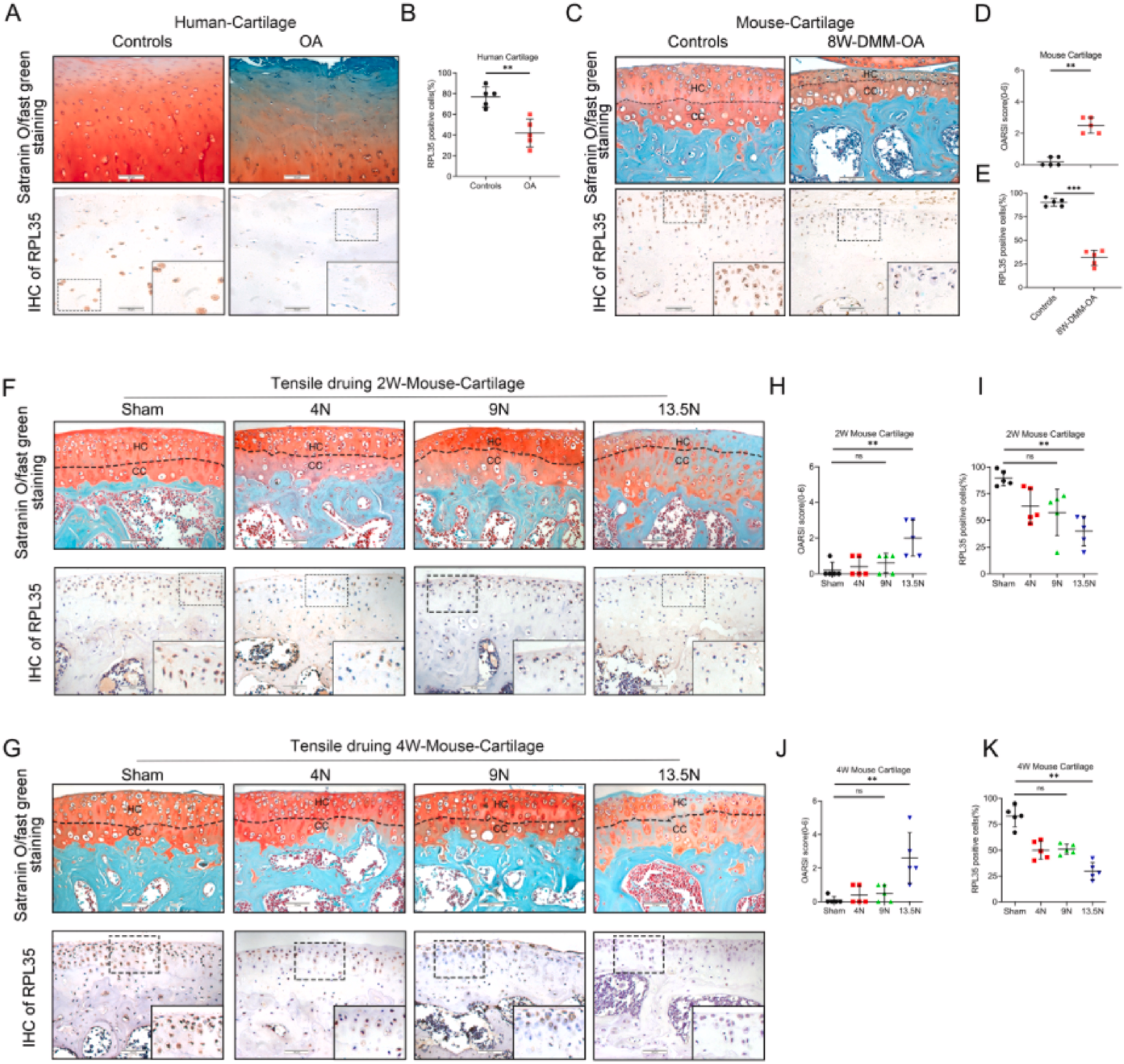 机械超负荷下调核糖体蛋白L35 通过 Hedgehog-Gli1 信号促进软骨细胞衰老和骨关节炎进展