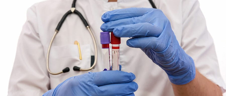 肌酸激酶MB检测 肌酸激酶MB检测