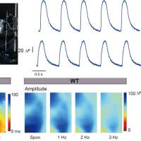iPSC-CMs细胞及类器官检测