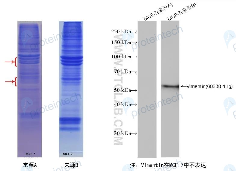 WB又出现杂带，你考虑过这个环节吗？