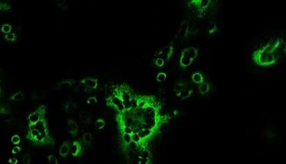 原价6000元1mg的PEDV-S蛋白单抗，促销2000元1mg