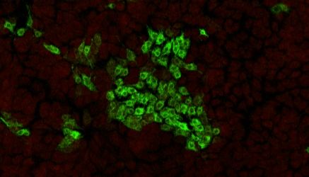 猪瘟CSFV-E2蛋白单抗试用装免费领取
