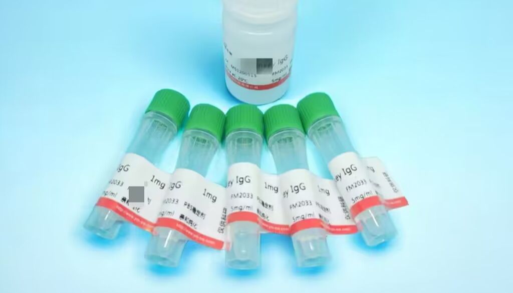 【抗原检测】双抗体夹心法的操作步骤