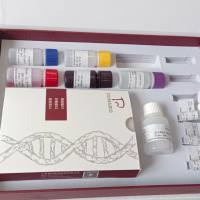 鸡膀胱肿瘤抗原(BTA)ELISA试剂盒 