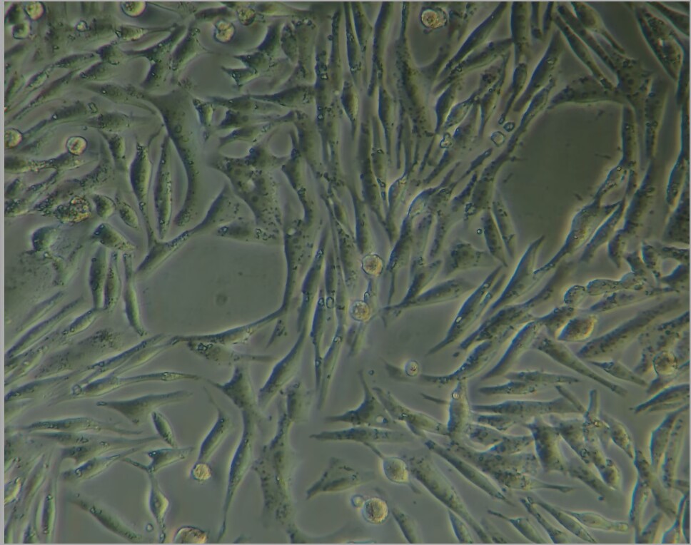 胃肠道间质瘤（GIST）的药物筛选
