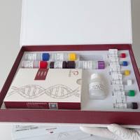 鸡鸟苷酸环化酶激活因子2B(GUCA2B)ELISA试剂盒