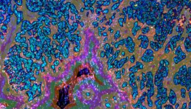 爱必信全景多标记组织微环境染色分析