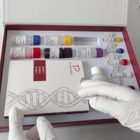 鸡轴蛋白抑制蛋白2(AXIN2)ELISA试剂盒