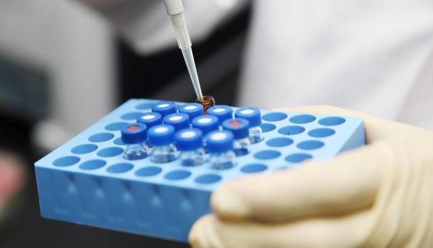 弓形虫（TOX）核酸检测试剂盒说明书