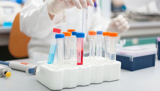 禽腺病毒(FADV)PCR试剂盒预期用途