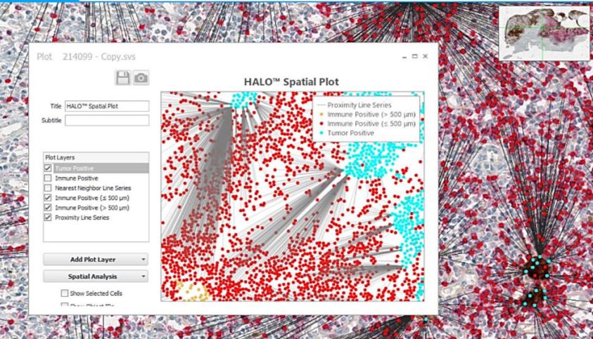 爱必信多色分析服务--HALO病理图像分析