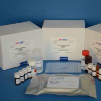 人抗兰尼碱受体钙释放通道抗体（RyR-Ab）ELISA 检测试剂盒