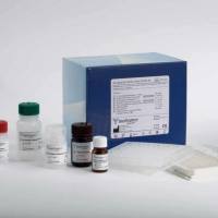 人(Human)抗兰尼碱受体钙释放通道抗体(RyR-Ab)ELISA 检测试剂盒