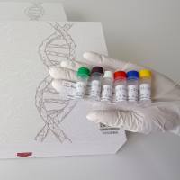 Home sapiens-Derived Material人源性成分DNA PCR试剂盒(不含内参)