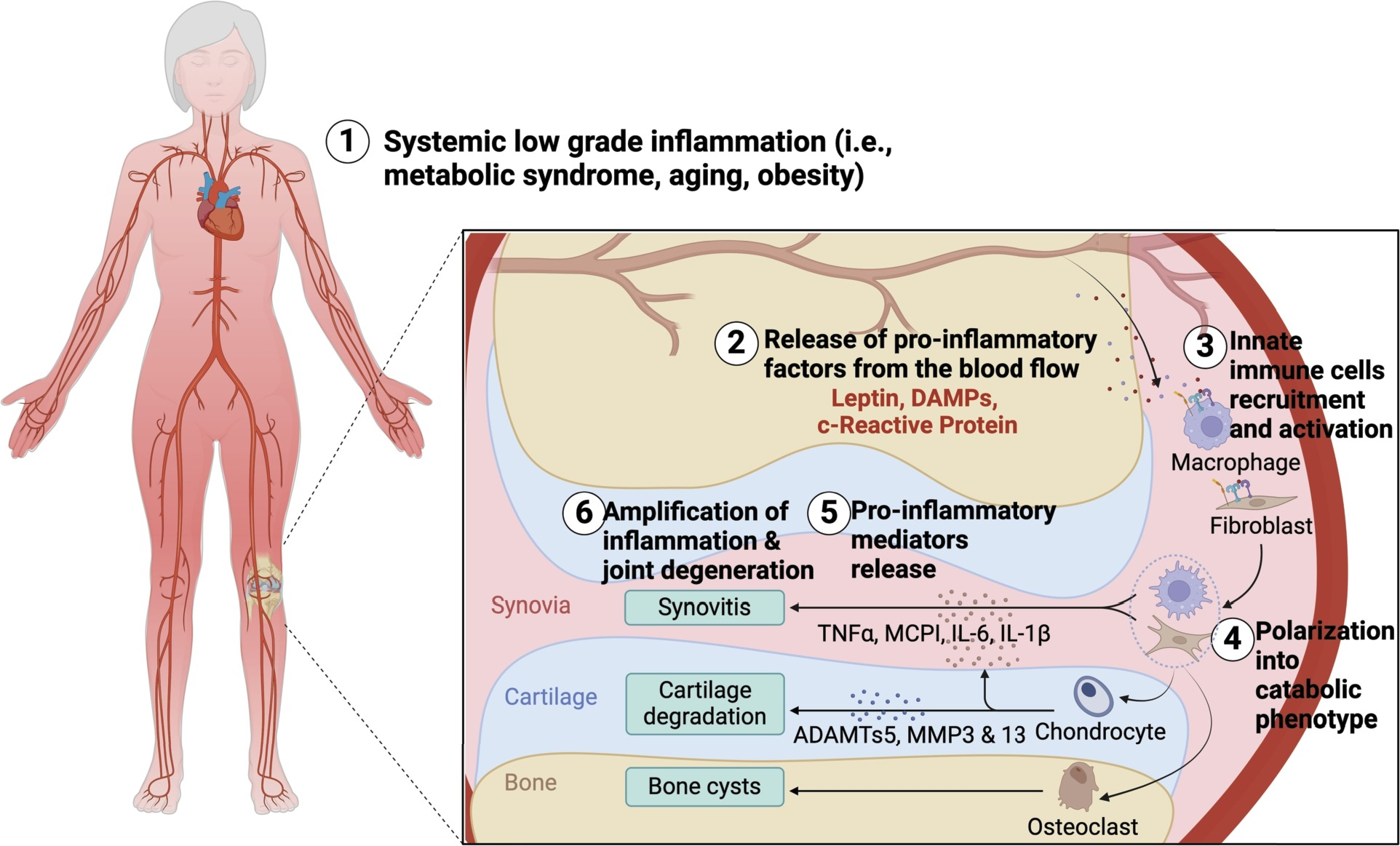 软骨细胞生化介质与机械转导之间的相互作用：揭示原发性膝关节骨关节炎中的差异反应