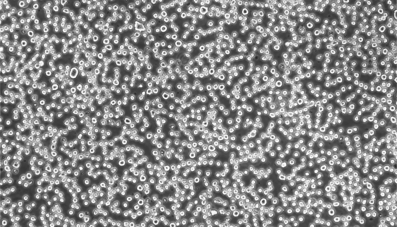 干货|THP-1分化成巨噬细胞诱导攻略