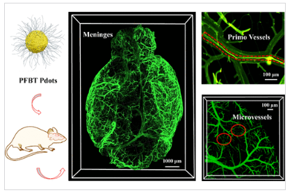 MegaSPIM 应用成果:脑膜血管网络 3D 重建与量化