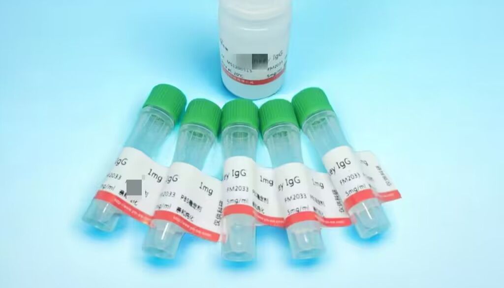 各种类抗体的主要特性和功能说明