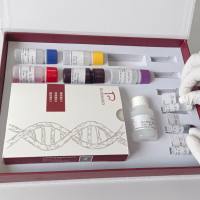 Human Endogenous Retroviruses W family (HERV-W)人类内源性逆转录病毒W家族RT-PCR试剂盒