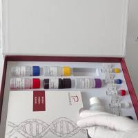 Diffusely Adherent E.coli(DAEC)弥散黏附性大肠杆菌（大肠埃希菌）PCR试剂盒