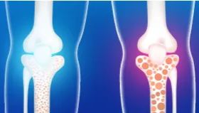 2024年世界骨质疏松日：抗击脆弱骨骼，华美生物助力科研与预防