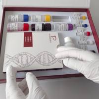 Coxsackie Virus(CVA6)柯萨奇病毒CVA6型变种RT-PCR试剂盒