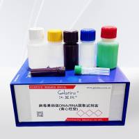  病毒基因组DNA/RNA提取试剂盒(离心柱型) 