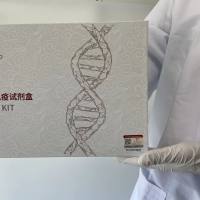 SARS-CoV-2冠状病毒(新冠病毒)N基因RT-PCR试剂盒