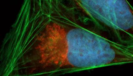 如何应对基于细胞的高通量筛选挑战