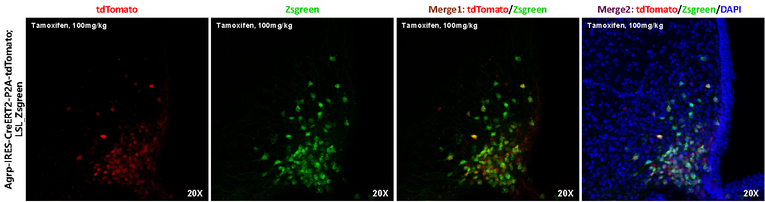 Agrp-IRES-CreERT2-P2A-tdTomato小鼠